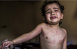 Syrian Family’s Agony Raises Specter of Chemical Warfare